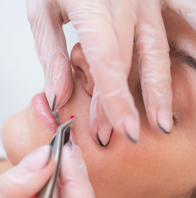 Electrolysis is a treatment approach for permanent hair removal. 

Today, there exists only one FDA-approved method for permanent hair removal, and that’s Electrolysis! ✔️ 

#medispa #botox #beauty #antiaging #aesthetics #fillers #medicalspa #juvederm #microneedling #skin