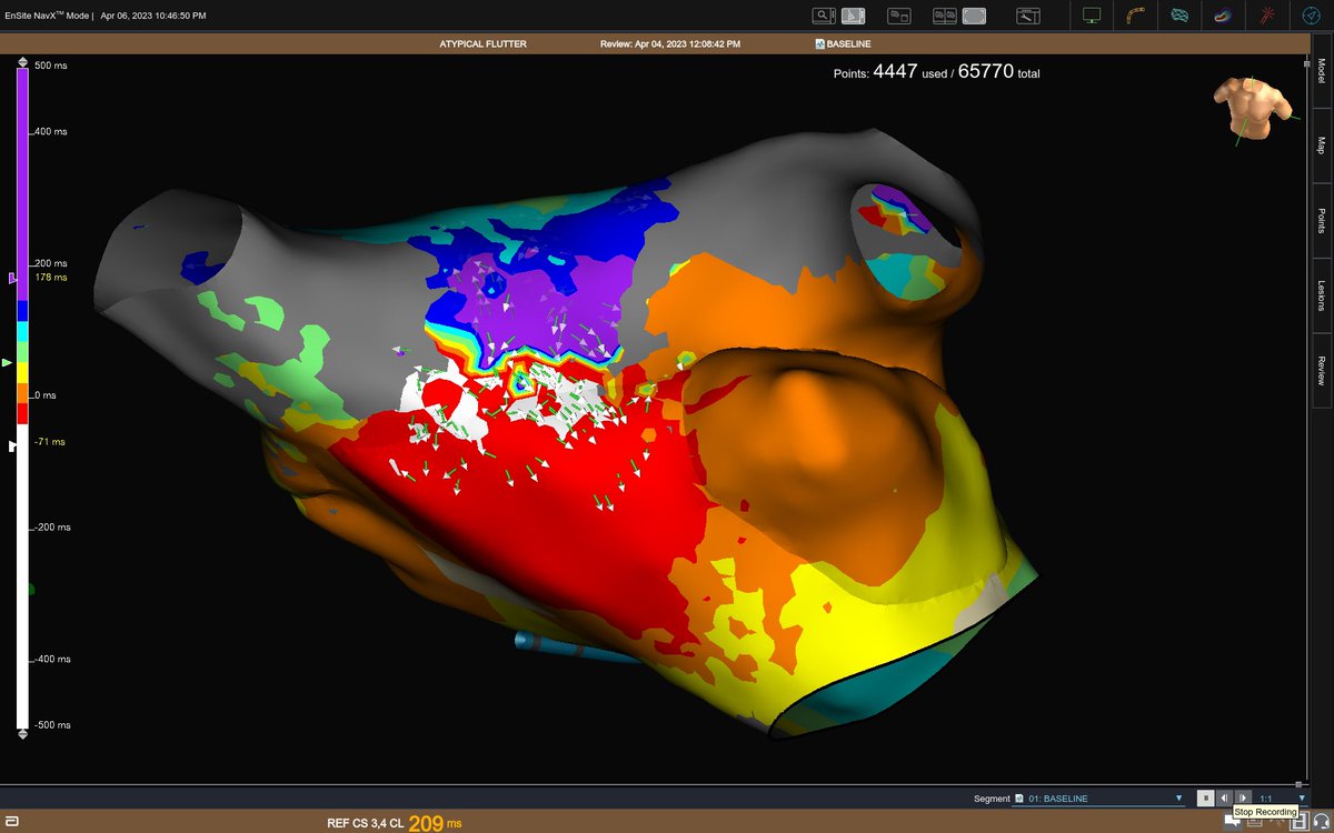 EP in the OC tweet media