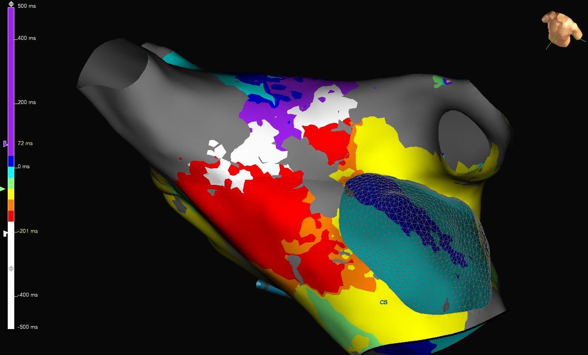 EP in the OC tweet media