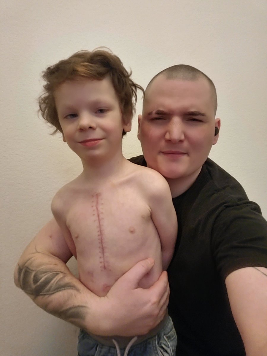 patriotwar90's tweet photo. Please do us a favor and FOLLOW our page for Jacob!

As you know my son jacob is 6 years old and he has Williams Syndrome and is recovering from a 30+ Hr
Double Pulmonary Artery Reconstruction Heart Surgery
And was under anesthesia for almost 13 days.

We are struggling to raise enough for his bills but if we get a lot of followers that may increase our chance to raise money.

If anyone wants to donate You can help our baby boy below 💙

CASHAPP: JoeGurko
VENMO: JoeGurko

GIVESENDGO:

https://t.co/512Mq0AozP