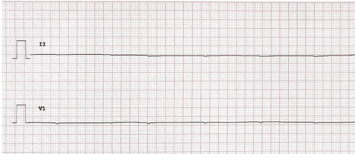 Dr Ulhas Pandurangi tweet media