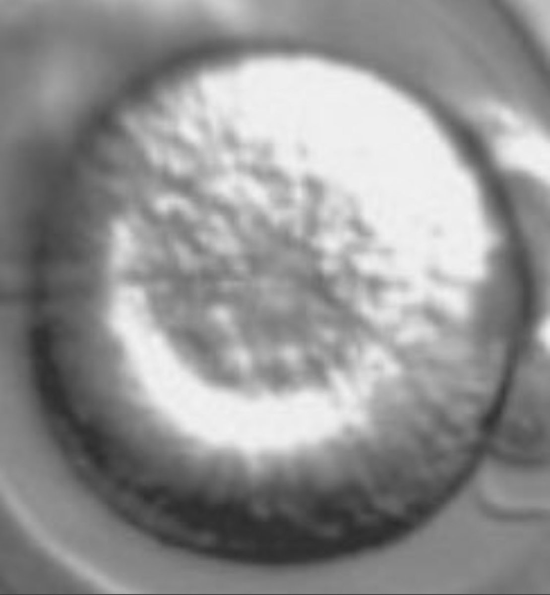 tedlieu's tweet photo. For the first 12 hours after fertilization, the fertilized egg remains a single cell. Is that a human being? I don’t know. But I do know this: that decision should be made by the woman, not by MAGA Republican politicians or religious zealot judges.

https://t.co/iPGC1xI5N2 https://t.co/GfYbpLNFTT