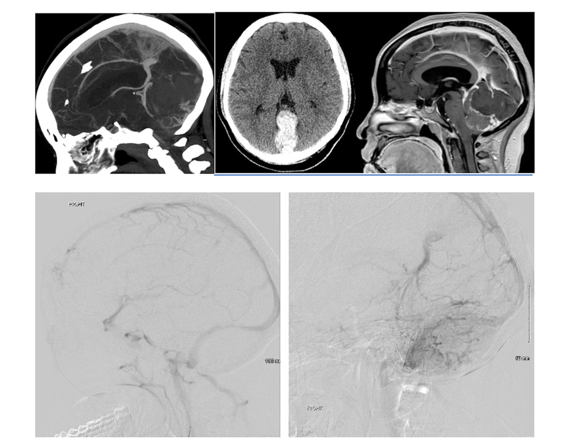 University of South Florida Neurosurgery tweet media