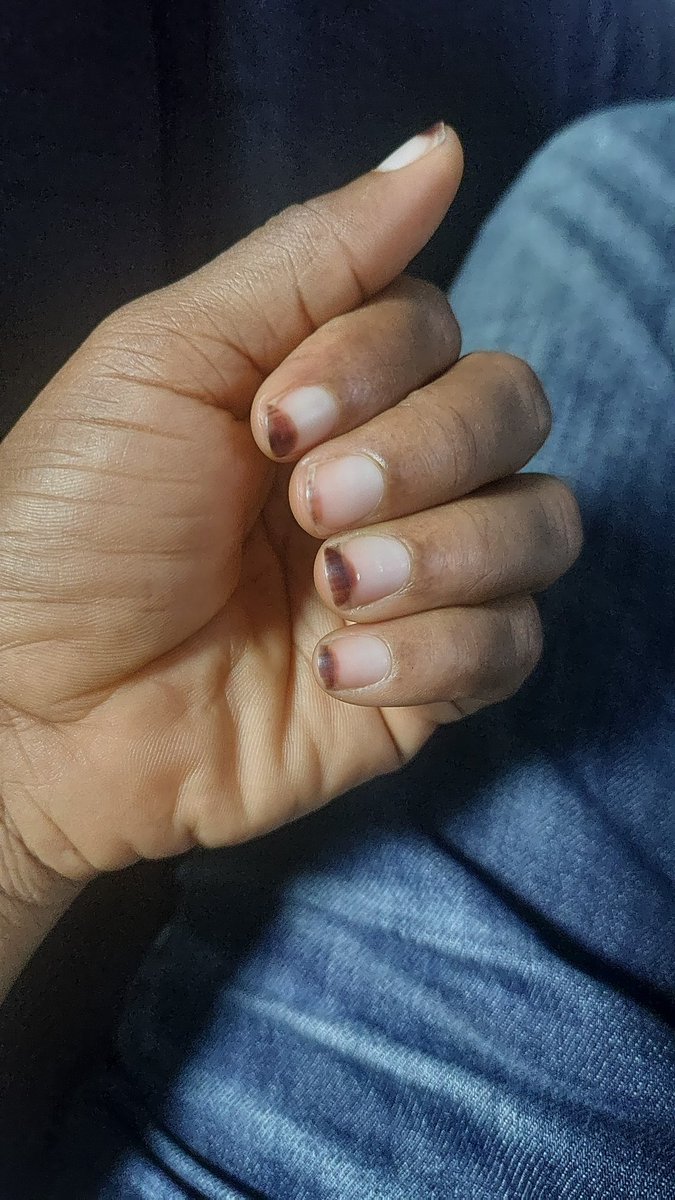 oyindar21's tweet photo. @FirstDoctor #fingerchallenge https://t.co/WP5LolvlLz