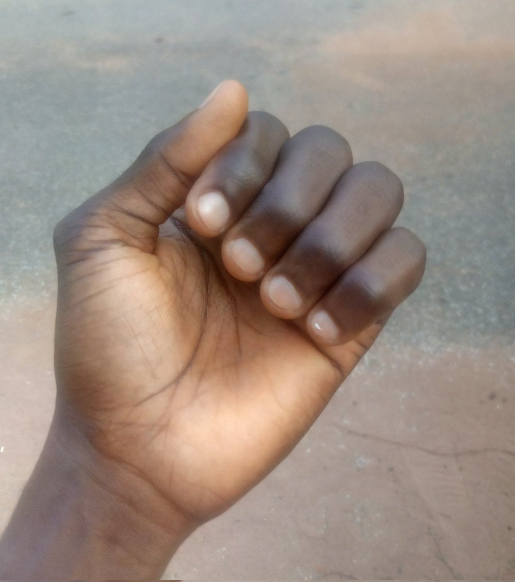 JonathanGoodne7's tweet photo. @FirstDoctor #FingerChallenge https://t.co/uZdbavjBLN