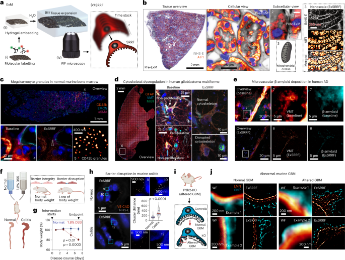 NatureNano's tweet photo. New content online: Expansion-enhanced super-resolution radial fluctuations enable nanoscale molecular profiling of pathology specimens https://t.co/6acredruFP https://t.co/ustu0RnBkq