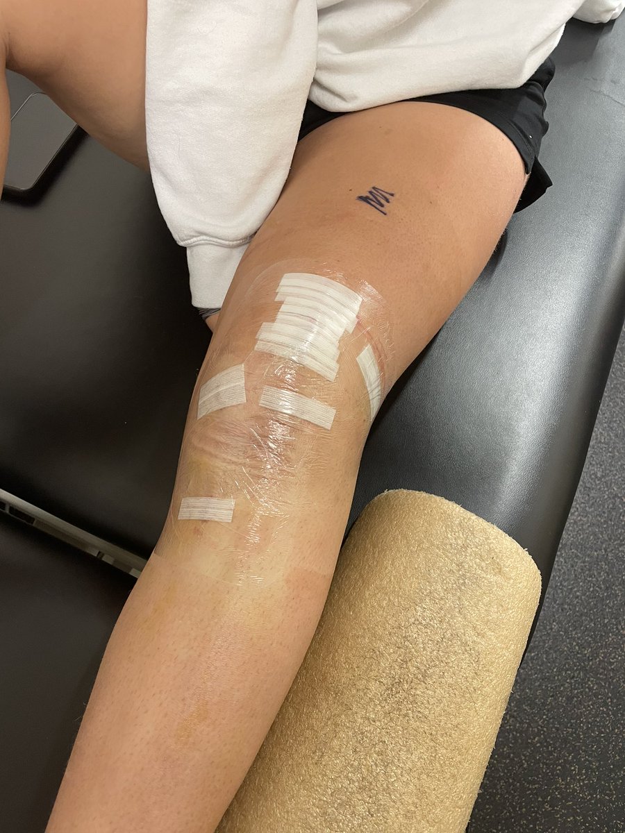 Surgery done and now it’s time to recover!