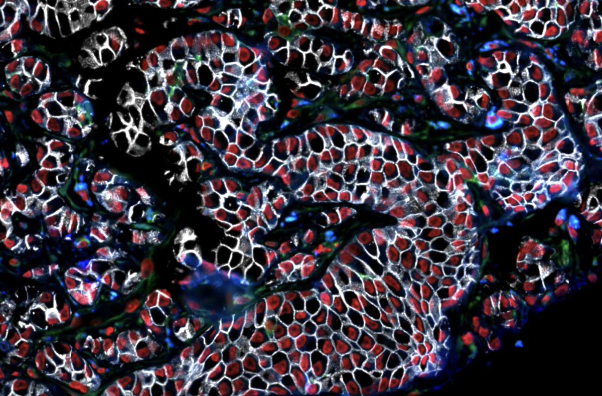 Do you see a 🦖?? Multiplexed imaging data of Breast Cancer! #htan #spatialbiology