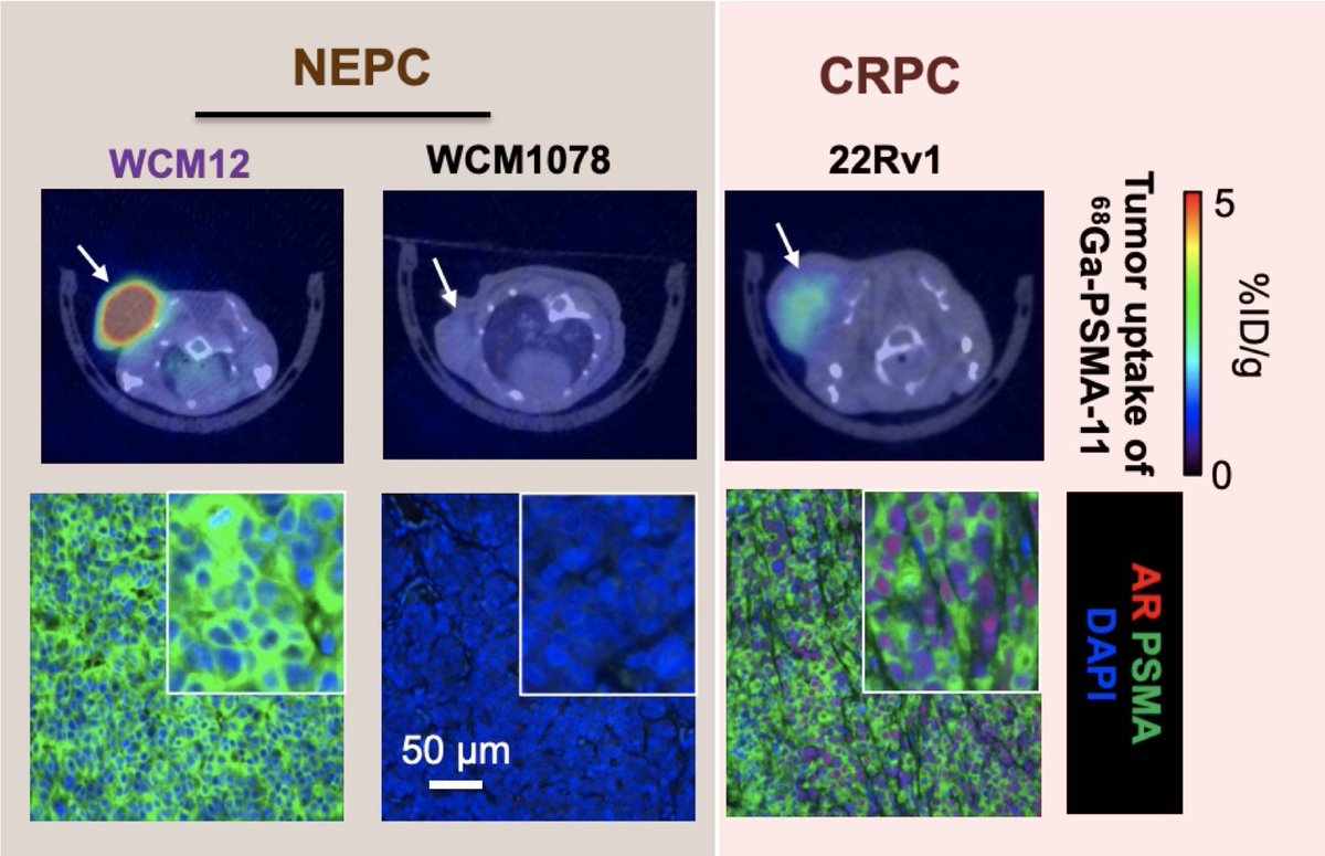 Misha Beltran (@mishabeltran) on Twitter photo So excited to share our new paper <a href="/NatureCancer/">Nature Cancer</a> on PSMA regulation in AR-positive and AR-negative prostate cancer. Congratulations to lead author <a href="/mkbakht/">Martin Bakht</a> <a href="/DanaFarber/">Dana-Farber</a> We are grateful for many wonderful collaborators <a href="/DanaFarber_GU/">Dana-Farber Lank Center for Genitourinary Oncology</a> <a href="/PCF_Science/">PCF Science</a>
nature.com/articles/s4301… So excited to share our new paper <a href="/NatureCancer/">Nature Cancer</a> on PSMA regulation in AR-positive and AR-negative prostate cancer. Congratulations to lead author <a href="/mkbakht/">Martin Bakht</a> <a href="/DanaFarber/">Dana-Farber</a> We are grateful for many wonderful collaborators <a href="/DanaFarber_GU/">Dana-Farber Lank Center for Genitourinary Oncology</a> <a href="/PCF_Science/">PCF Science</a>
nature.com/articles/s4301…