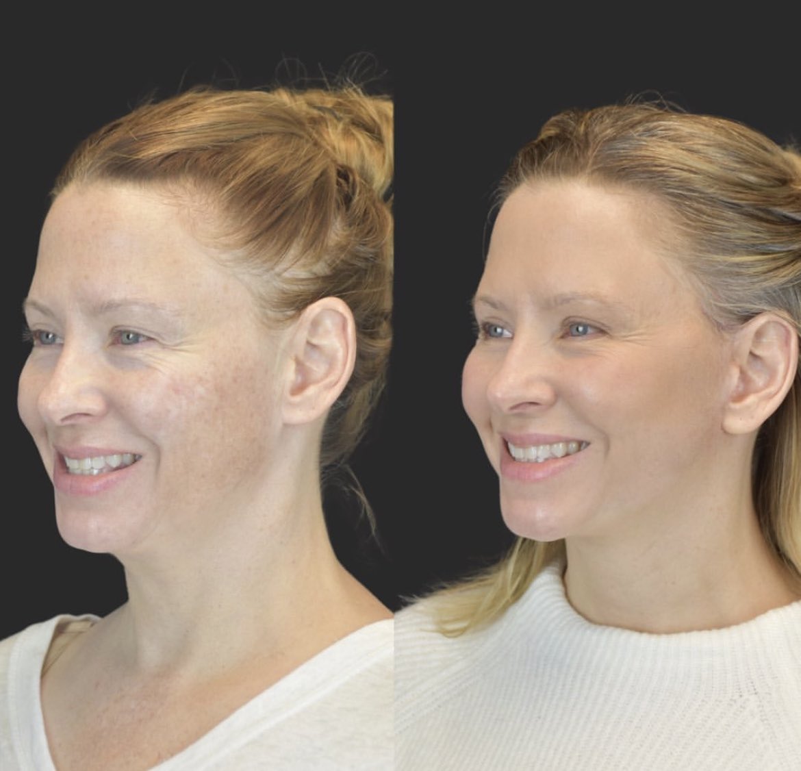 The Cosmetic Lane on Twitter "“I look like myself but more refreshed