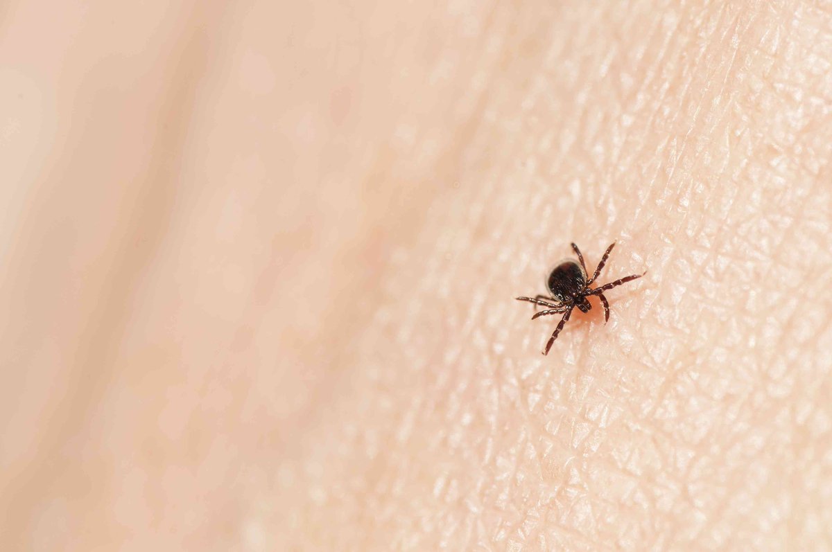 SynapseGroupInc's tweet photo. What is Babesiosis?  #synpasereads #whatwearereading #companypride https://t.co/YKHbvnKVDq https://t.co/YGtlYlGrah