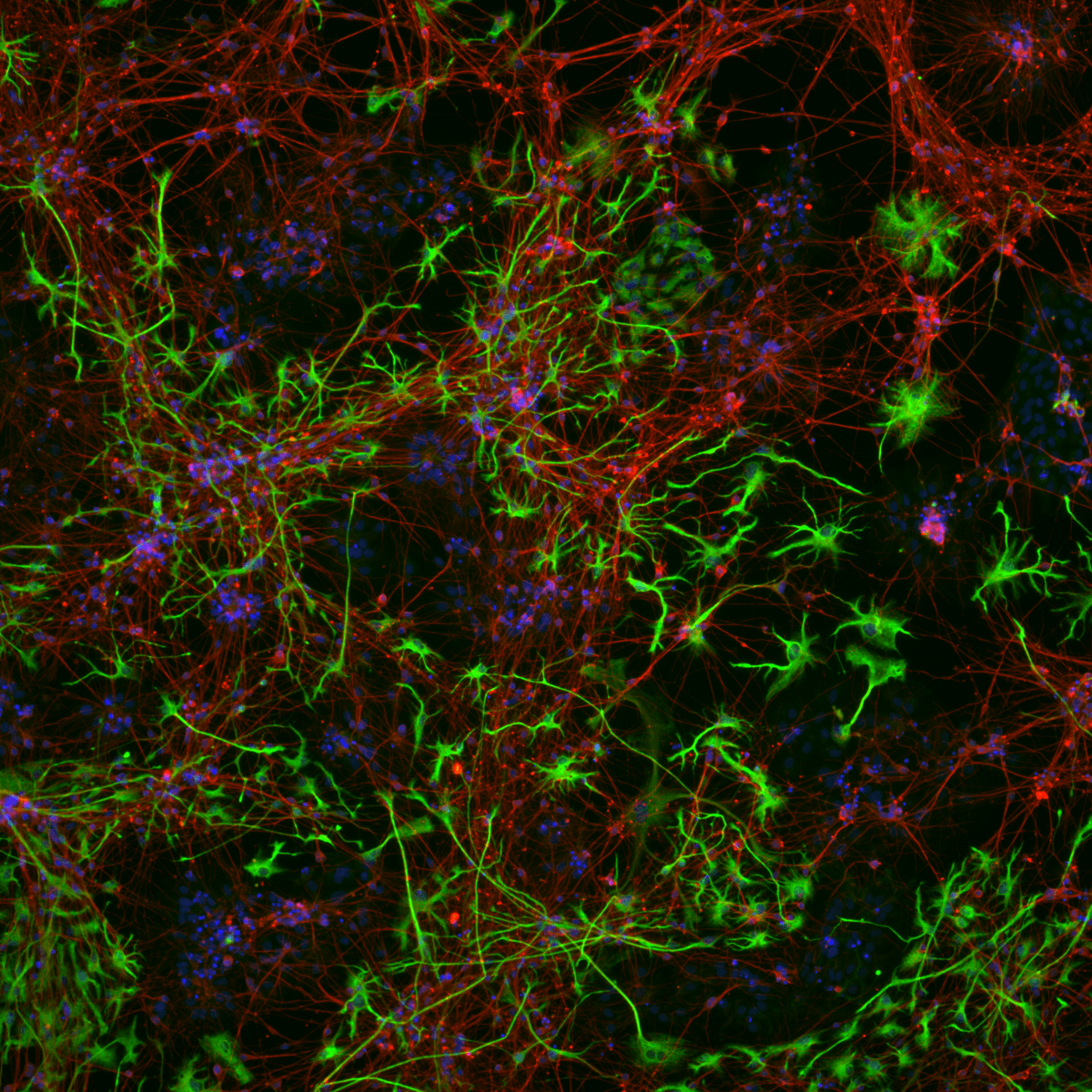 chrost_hugo's tweet photo. Beautiful neurons in red, astrocytes in green, nuclei in blue.

Credits:  Noëmie / @STEMCELLTech

#neuorscience https://t.co/qdSeVRJQJF