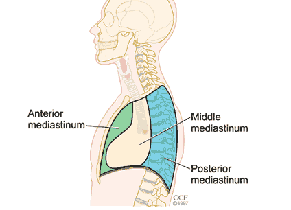Simone and Jules report to our #GreysAnatomy patient that she has a mediastinal mass, with a tissue diagnosis of a thymoma.

These tumors may be malignant (cancerous), but they’re usually benign (noncancerous). Surgery is the most common treatment.
