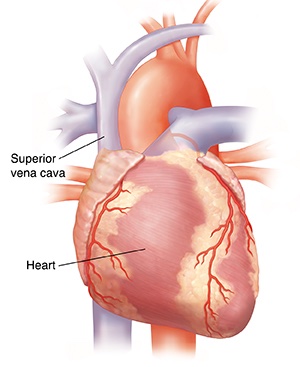 Superior vena cava syndrome (SVCS) is a group of problems caused when blood flow through the superior vena cava is slowed down.

Common symptoms of SVC syndrome are:
✅Trouble breathing
✅Coughing
✅Swelling of the face, neck, upper body, and arms
#GreysAnatomy