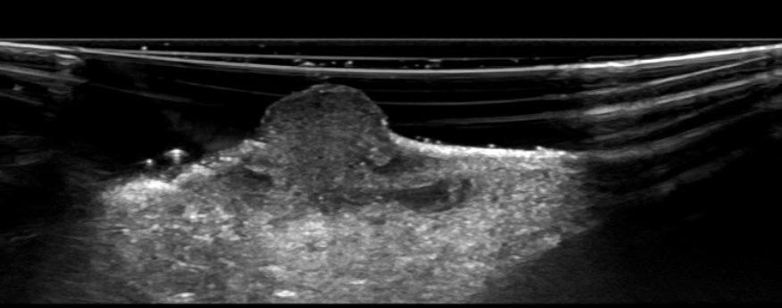 UW_MSKrad's tweet photo. #CaseOfTheWeek ‼️🎉‼️
☢️🩻☠️Case #15☠️🩻☢️
New case from @xradiasian‼️
#HandMass #ShortIntervalGrowth
➡️➡️➡️ Diagnosis❓❓
#MSKRad #FOAMrad #radres #MedEd #RadEd #OrthoTwitter #HandAndUpperExtremity #Derm @ssr_rwg @UWRadRes @HandSociety @AADskin https://t.co/ktzHOq54E3