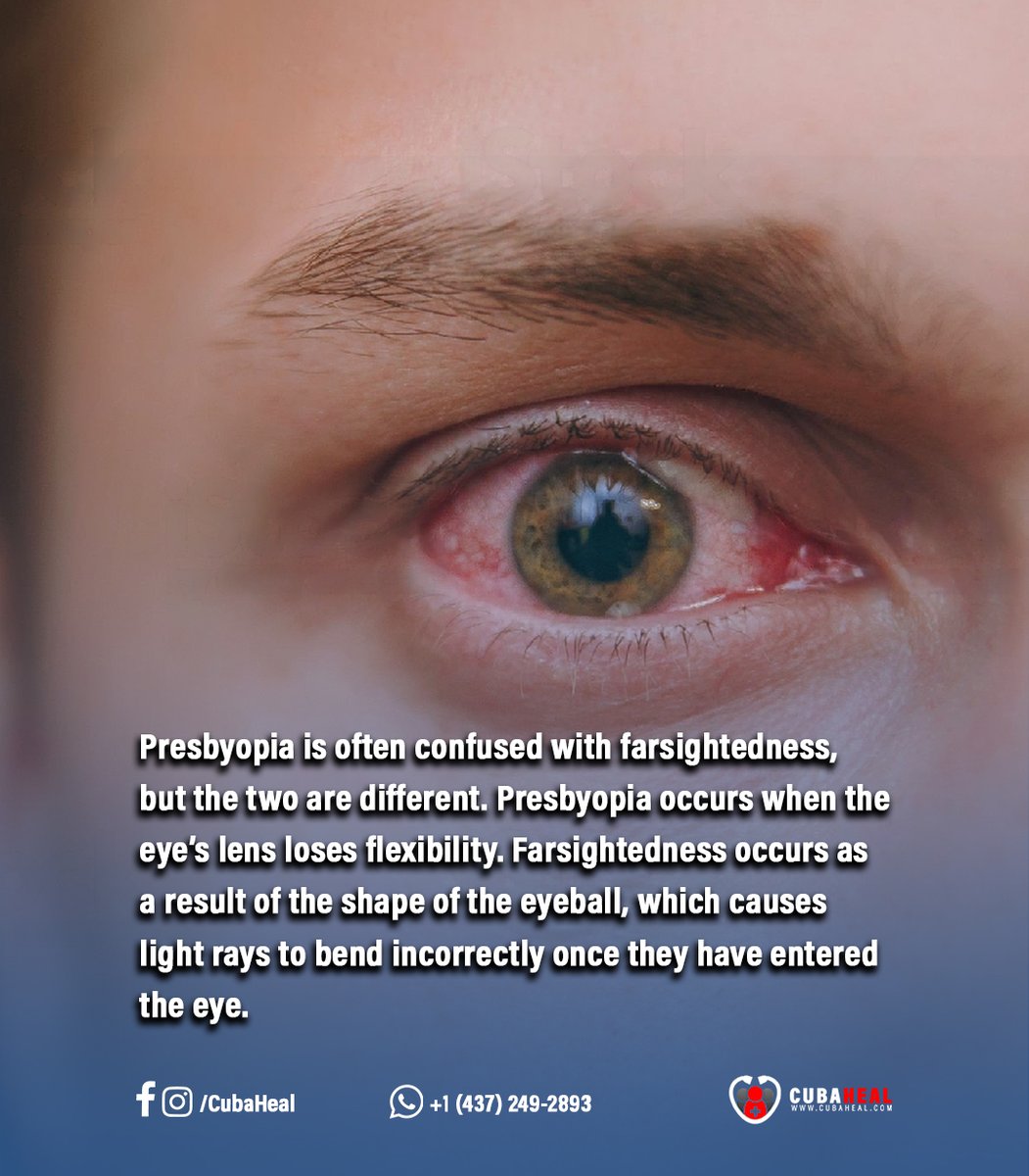 Cuba_Heal's tweet photo. What is Presbyopia

Reach us by Whatsapp : +1 (437) 249-2893
Take a look to our website : https://t.co/xkDkKDehYk

#doctor #Medical #medicaleducation #memes #eyes #vision #eye #DidYouKnow #presbyopia https://t.co/2cKwa8p72s
