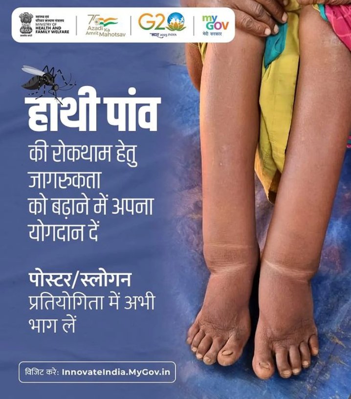gorkahpur's tweet photo. अपनी क्रियेटिविटी के जरिए हाथी पांव की रोकथाम व खात्मे के लिए जागरूकता फैलाएं।

हाथी पांव पर पोस्टर डिजाइन और स्लोगन प्रतियोगिता में भाग लें।

अधिक जानकारी के लिए विजिट करें: https://t.co/Fk3r1Ipihy

lymphatic-chal... https://t.co/C2sVI6zPD7