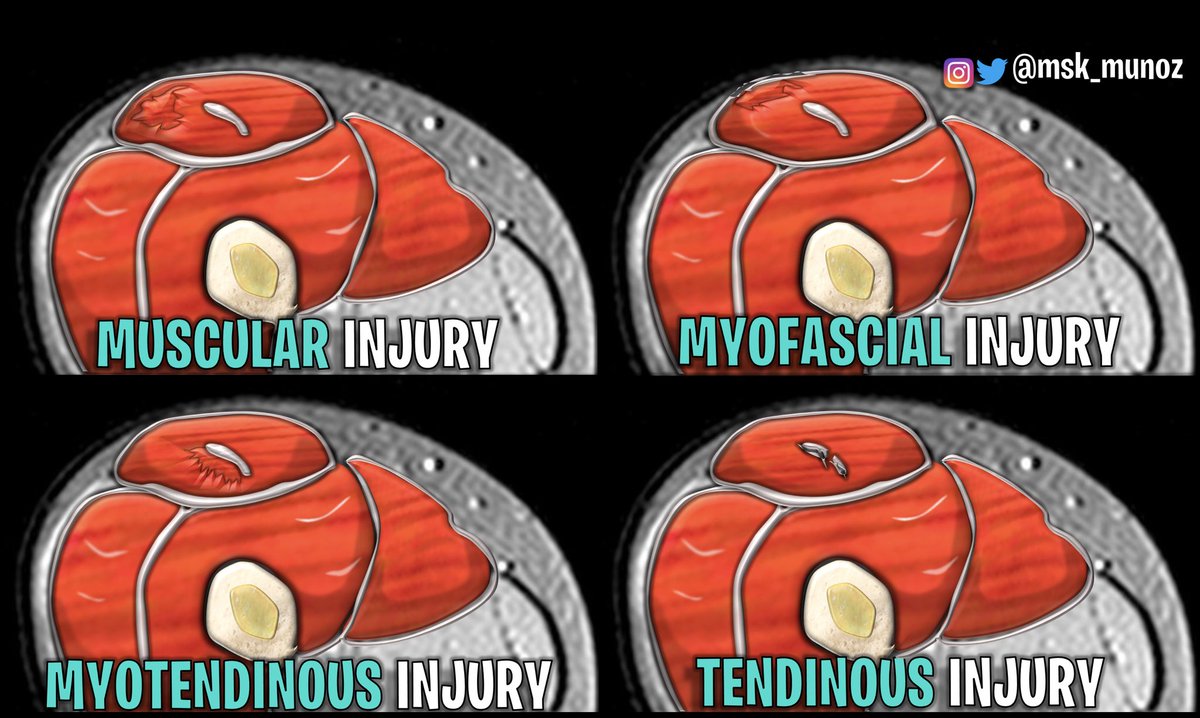 JPMunozMSK on Twitter "CONNECTIVE ARCHITECTURE •Macroscopy, in