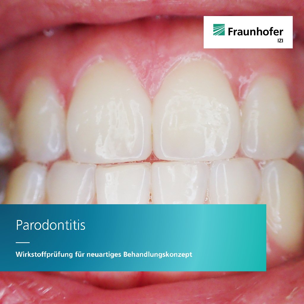 FraunhoferIZI's tweet photo. Neuartige Therapeutika gegen #Parodontitis: #PerioTrap Pharmaceuticals, #FraunhoferIZI, @Presse_IMWS & Skinomics prüfen Wirkstoffkandidaten auf Wirksamkeit & Sicherheit, um Voraussetzung für klinische Studie zur erstmaligen Testung im Menschen zu schaffen.
https://t.co/Fz9PcuDdKN https://t.co/R7q84F044i