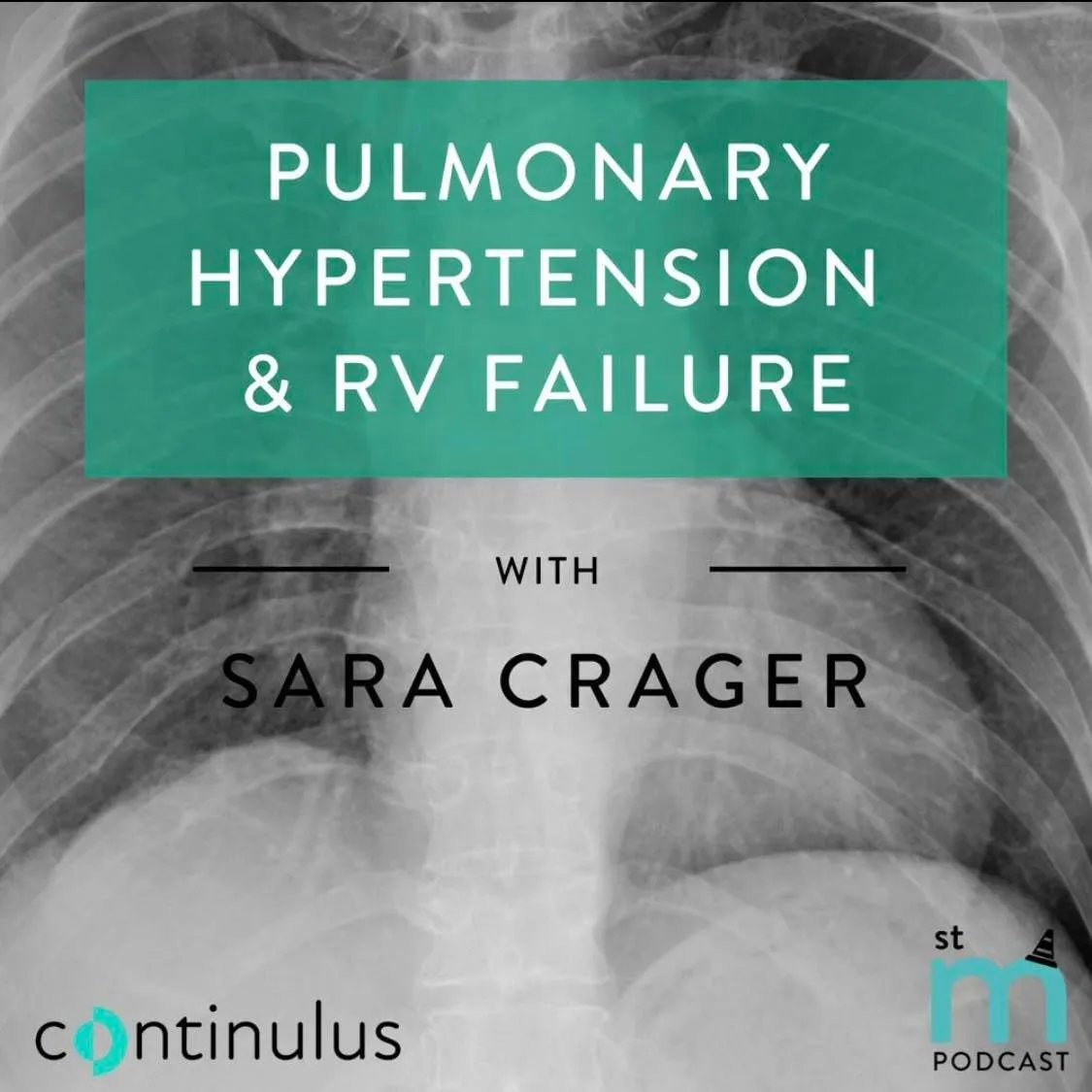 🔥 Listen to the new St Mungos podcast! Sara Crager: 'Pulmonary Hypertension & RV Failure'👀 🔗 stmungos-ed.com/podcast/sara-c… @SaraCrager @continulus #FOAMed #hypertension #ED