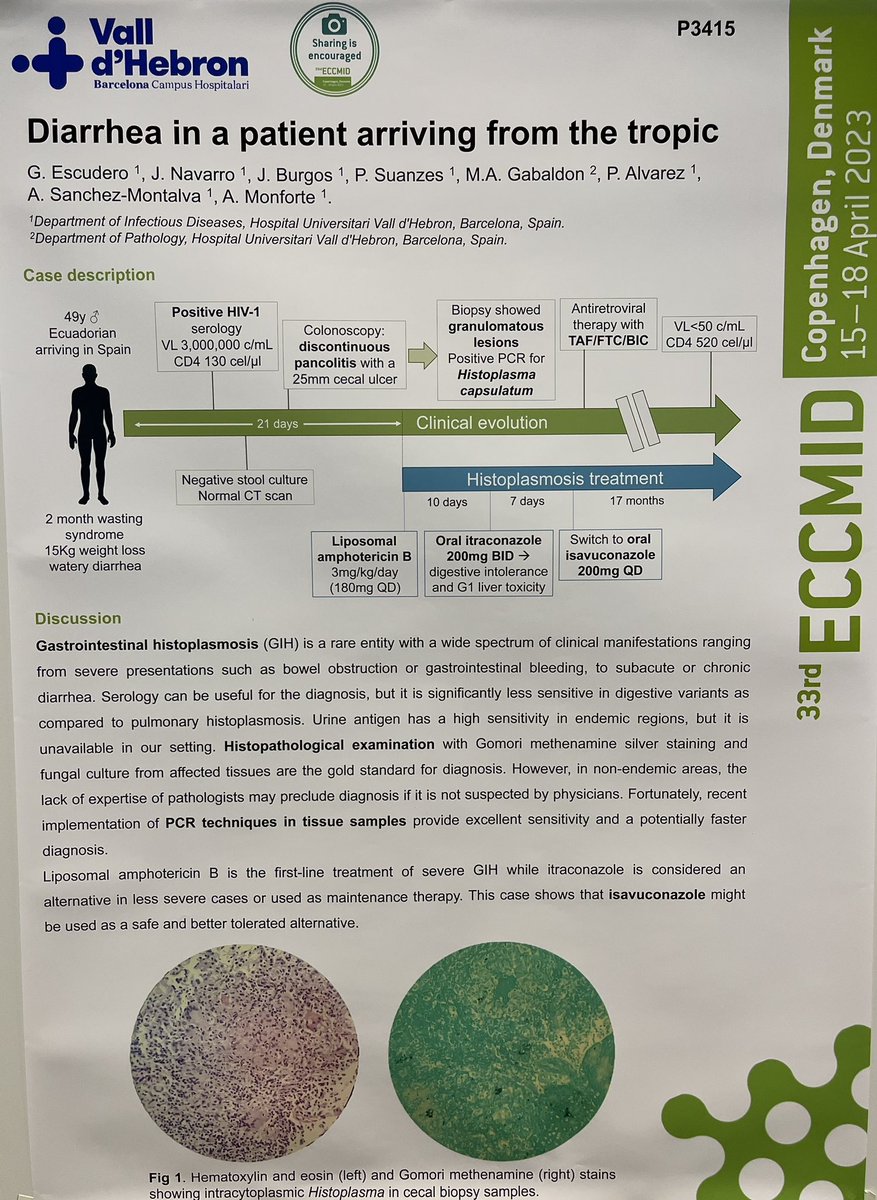 GonEscudero1's tweet photo. Gastrointestinal Histoplasmosis in a newly diagnosed HIV patient arriving from the tropic, today at #ECCMID23 🧫🦠 https://t.co/03VEHG2NUc