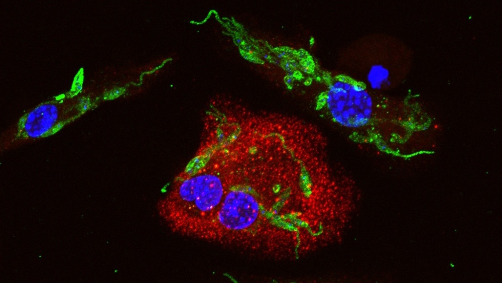 Agência FAPESP (@agenciafapesp) on Twitter photo Parasita da #leishmaniose manipula defesa do organismo para continuar se replicando, mostra estudo. Divulgada em <a href="/NatureComms/">Nature Communications</a> por pesquisadores da <a href="/usponline/">USP - Universidade de São Paulo</a>, a descoberta abre caminho para novos tratamentos. agencia.fapesp.br/41156/ Parasita da #leishmaniose manipula defesa do organismo para continuar se replicando, mostra estudo. Divulgada em <a href="/NatureComms/">Nature Communications</a> por pesquisadores da <a href="/usponline/">USP - Universidade de São Paulo</a>, a descoberta abre caminho para novos tratamentos. agencia.fapesp.br/41156/