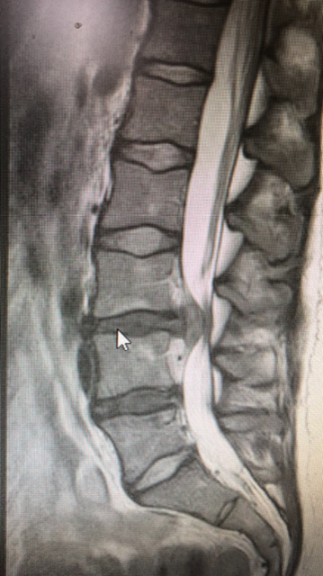Once upon a time there was a physio with CES

A thread....