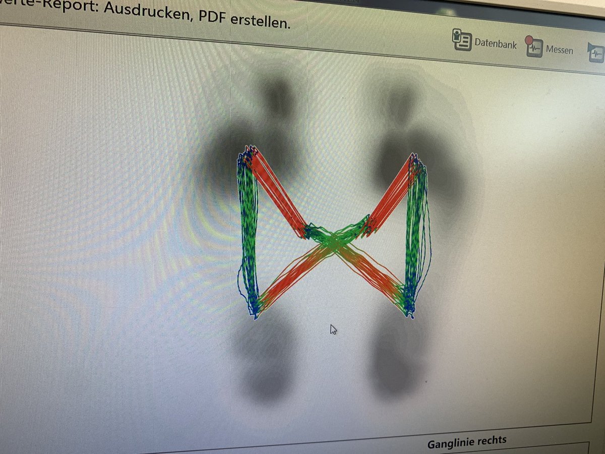 PetersenBerkley's tweet image. Visiting Dr. Bettina Wollesen’s lab at the University of Hamburg in Germany to engage in her cognitive-motor research projects. #research #VR #executivefunctions #cognitivemotor #dualtasking #gaitassessment
