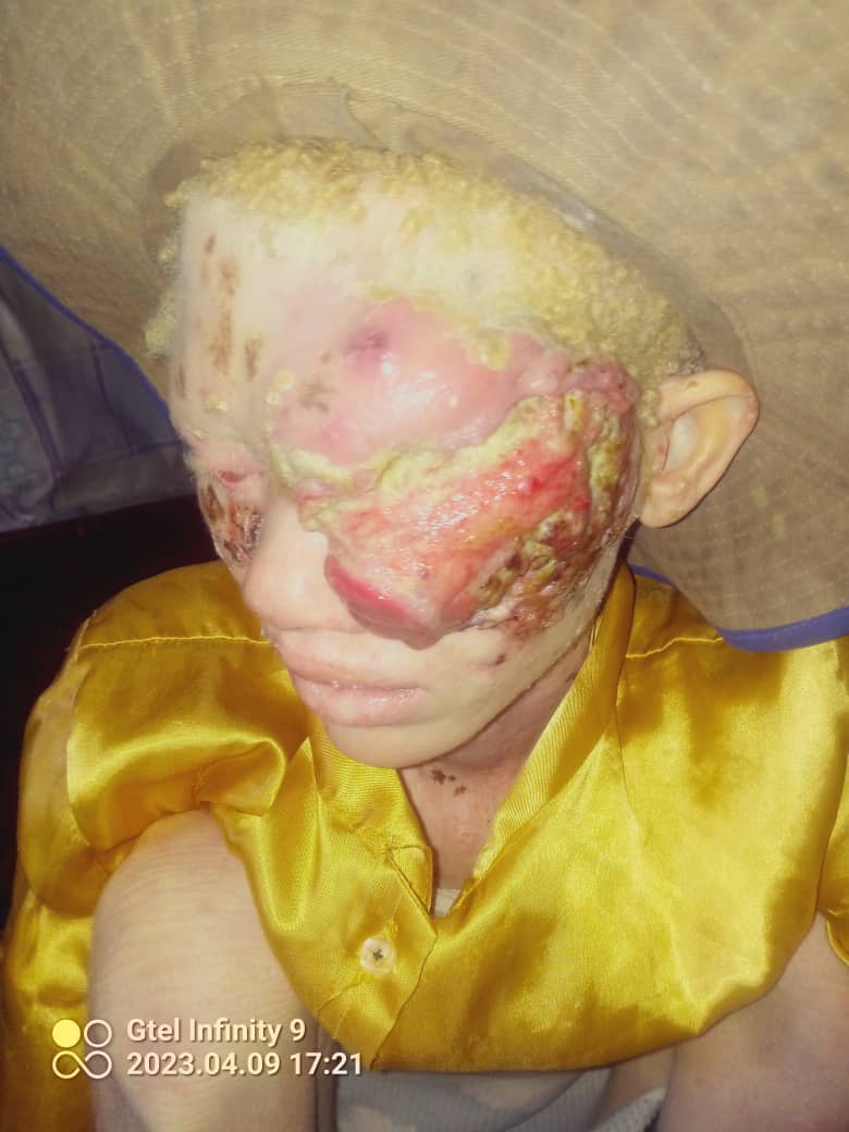 Im hurt, why God why 💔Tsitsi (17) is in pain, dont pass through this tweet without pressing retweet, maybe a well wisher is on your TL, Tsitsi may get help through you. She needs funds for food, transport, meds whilst we wait for the way forward from hospital. Contact 0719876747