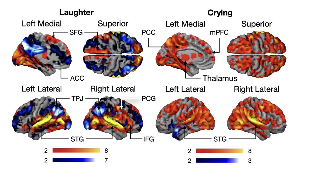 Lauri Nummenmaa (@lnummenmaa) on Twitter photo How does the brain encode signals of distress and prosociality from others? Our <a href="/TurkuPETCentre/">Turku PET Centre</a> and <a href="/UCL_ICN/">UCL ICN</a> collaborative project figured this out using large-scale multi-experiment fMRI with naturalistic stimulation, now out in <a href="/NeuroImage_EiC/">NeuroImage</a>: doi.org/10.1016/j.neur… How does the brain encode signals of distress and prosociality from others? Our <a href="/TurkuPETCentre/">Turku PET Centre</a> and <a href="/UCL_ICN/">UCL ICN</a> collaborative project figured this out using large-scale multi-experiment fMRI with naturalistic stimulation, now out in <a href="/NeuroImage_EiC/">NeuroImage</a>: doi.org/10.1016/j.neur…
