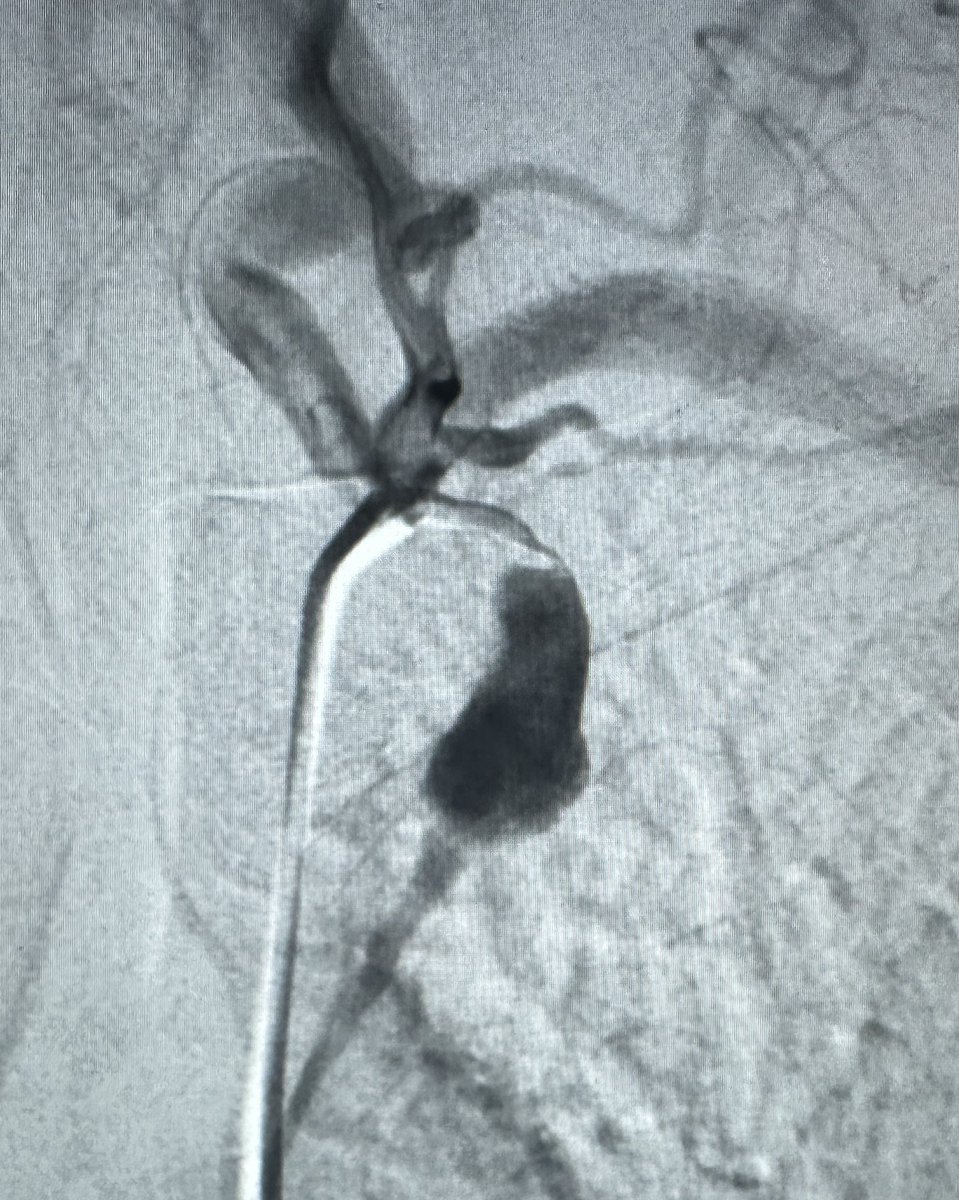 Zachary R Barnard (@ZRBNeurosurgery) / Posts / X