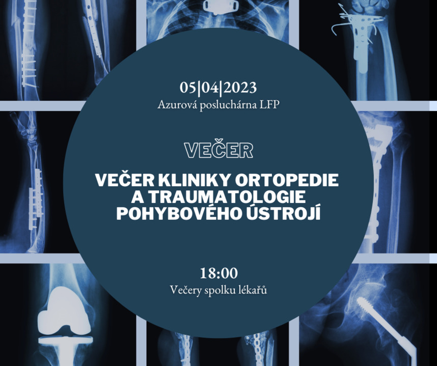 lfp_unikarlova's tweet photo. Zveme Vás na další večer spolku lékařů v kampusu LFP.
#lfplzen #pilsen #medicalfaculty #fnplzen #plzen #univerzitakarlova #unikarlova #medstudent #medici #lfp https://t.co/2BaRIxfe7E