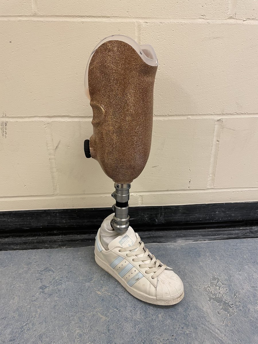 SarahWatson_PO's tweet photo. I always love delivering these sparkly sockets. This one features the new 
@medical_click dial allowing the patient to both tighten and loosen her socket with a simple turn of the dial. A nice upgrade from the old dials. 
#prosthetics #amputeerehab https://t.co/EB8u5458GR