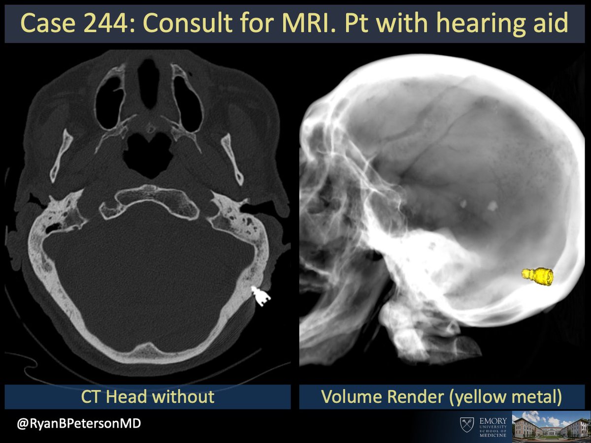 Ryan B Peterson 🇸🇪 tweet media