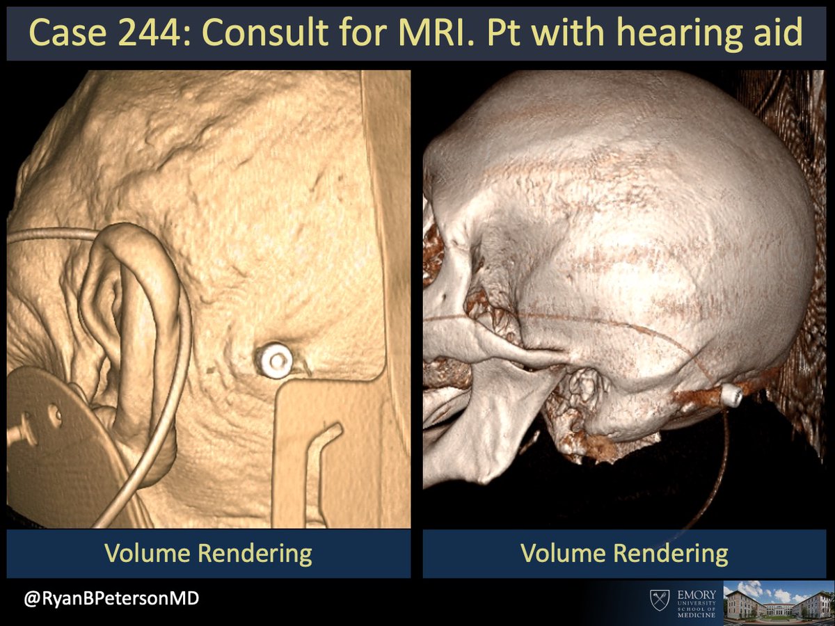 Ryan B Peterson 🇸🇪 tweet media