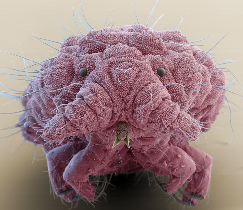 BigBangSciCom's tweet photo. Bilobella, un genre de collemboles, vue au M.E.B (l'image est colorisée)
#wildlife #animals #naturelovers #animaux #science #wildlife #nature #biologie #biology #SVT #microsope #imagerie https://t.co/MYVcZGUNyt