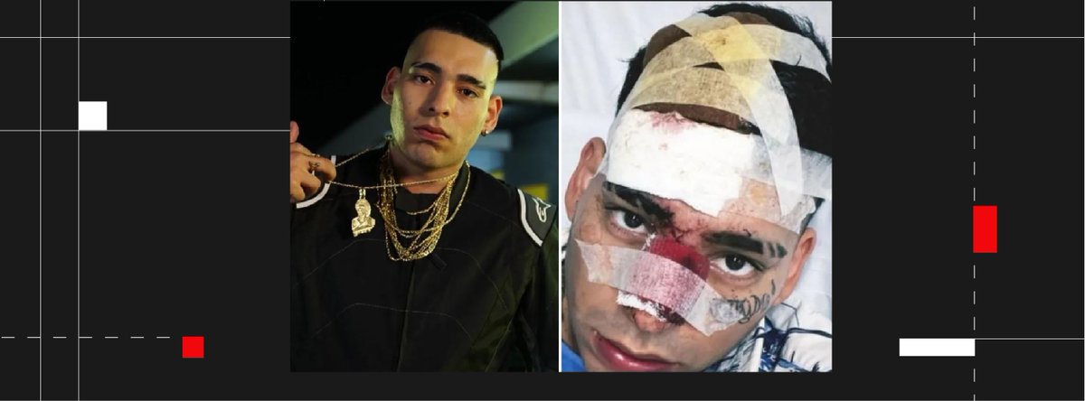 🚨 "SALÍ VIVO DE MILAGRO"
- El accidente del cantante Kaleb di Masi en la autopista del oeste
- Una joven filmó como quedó el auto y lo reconoció
- Investigan si corría picadas
📲 Las imágenes: viaszeta.com/2023/04/10/sal…