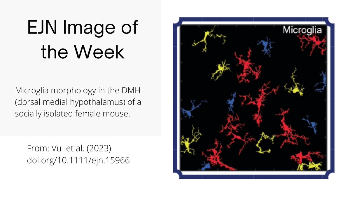 European Journal of Neuroscience (@ejneuroscience) on Twitter photo Check out the latest installment in our Image of the Week series!
From: doi.org/10.1111/ejn.15…
<a href="/FENSorg/">FENS</a>
<a href="/WileyNeuro/">Wiley Neuro</a>
<a href="/jrplemel/">Jason Plemel</a>
<a href="/_jesse_jackson/">Jesse Jackson</a>
<a href="/NMHI_UofA/">Neuroscience & Mental Health Institute - U of A</a> Check out the latest installment in our Image of the Week series!
From: doi.org/10.1111/ejn.15…
<a href="/FENSorg/">FENS</a>
<a href="/WileyNeuro/">Wiley Neuro</a>
<a href="/jrplemel/">Jason Plemel</a>
<a href="/_jesse_jackson/">Jesse Jackson</a>
<a href="/NMHI_UofA/">Neuroscience & Mental Health Institute - U of A</a>