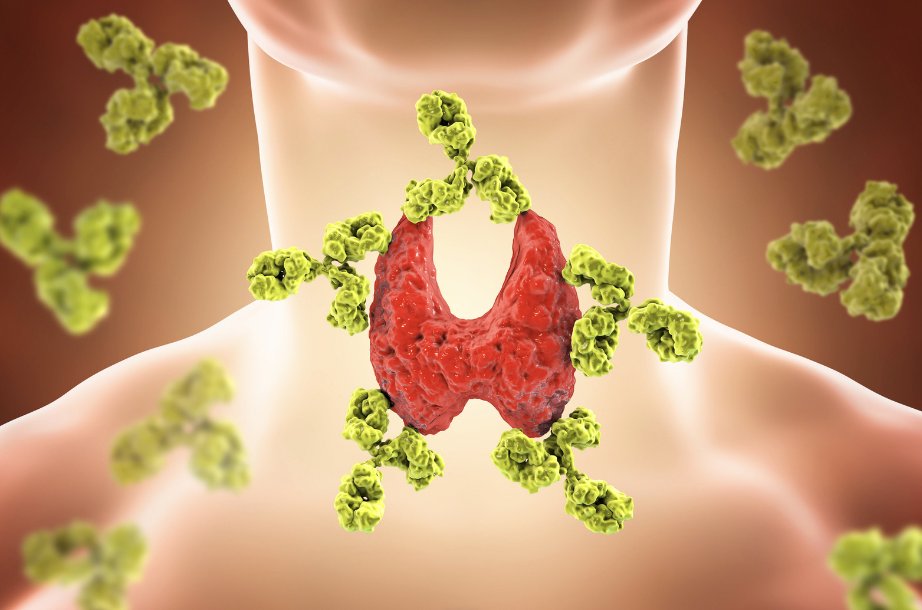 NIHClinicalCntr's tweet image. NIH doctors are studying new treatment methods in people with thyroid cancer that spread outside the thyroid and seeking patients age 18+. Travel and lodging may be provided. Call our Office of Patient Recruitment at 866-444-1134 for Study 19-DK-0050 bit.ly/3rvni46