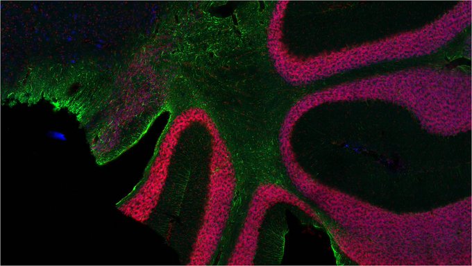 MBFBioscience's tweet photo. Want to stay in the MBF loop?
Sign up for our newsletter and be up to date about product updates, upcoming webinars, informative blog posts and more!
▶️ https://t.co/jGjcS6nYdM
#newsletter #neruoscience #MBFally #SupportScience https://t.co/eBN6ZqKKuF