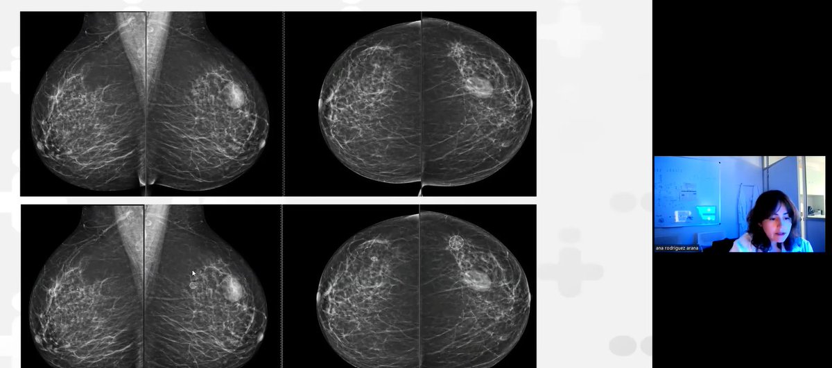 QUSTomproject's tweet photo. It's a wrap! The #QUSTom and @VHIR_ team would like to thank all those who attended the training "Imaging diagnosis in breast cancer: present and future". We hope to see you at our future events! Slides and recordings will soon be available here: https://t.co/l5bL0j0htQ https://t.co/1JAUv0DBDR
