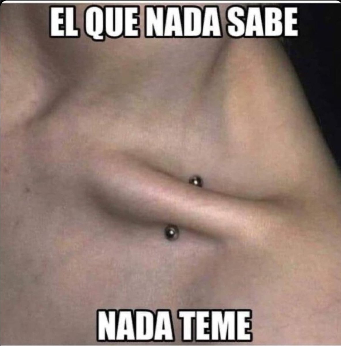 🧵Clavícula😱 ¿Qué se perforó?
#Hombro #Locomotor #Anatomia