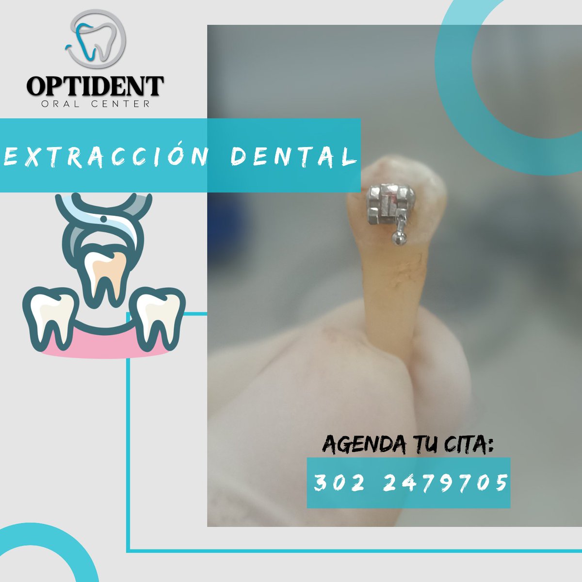 OptidentOralCen's tweet photo. Extracción por Ortodoncia 
¿Le tienes miedo a la Odontología? danos la oportunidad de atenderte.
Comunícate vía WhatsApp: 3022479705
https://t.co/A9U6qXAAuz
#ortodoncia  #extraccionesdentales  #odontologia  #yumbo #optident #optidentoralcenter  #dolor #extraccion https://t.co/tWxiI9jgjt