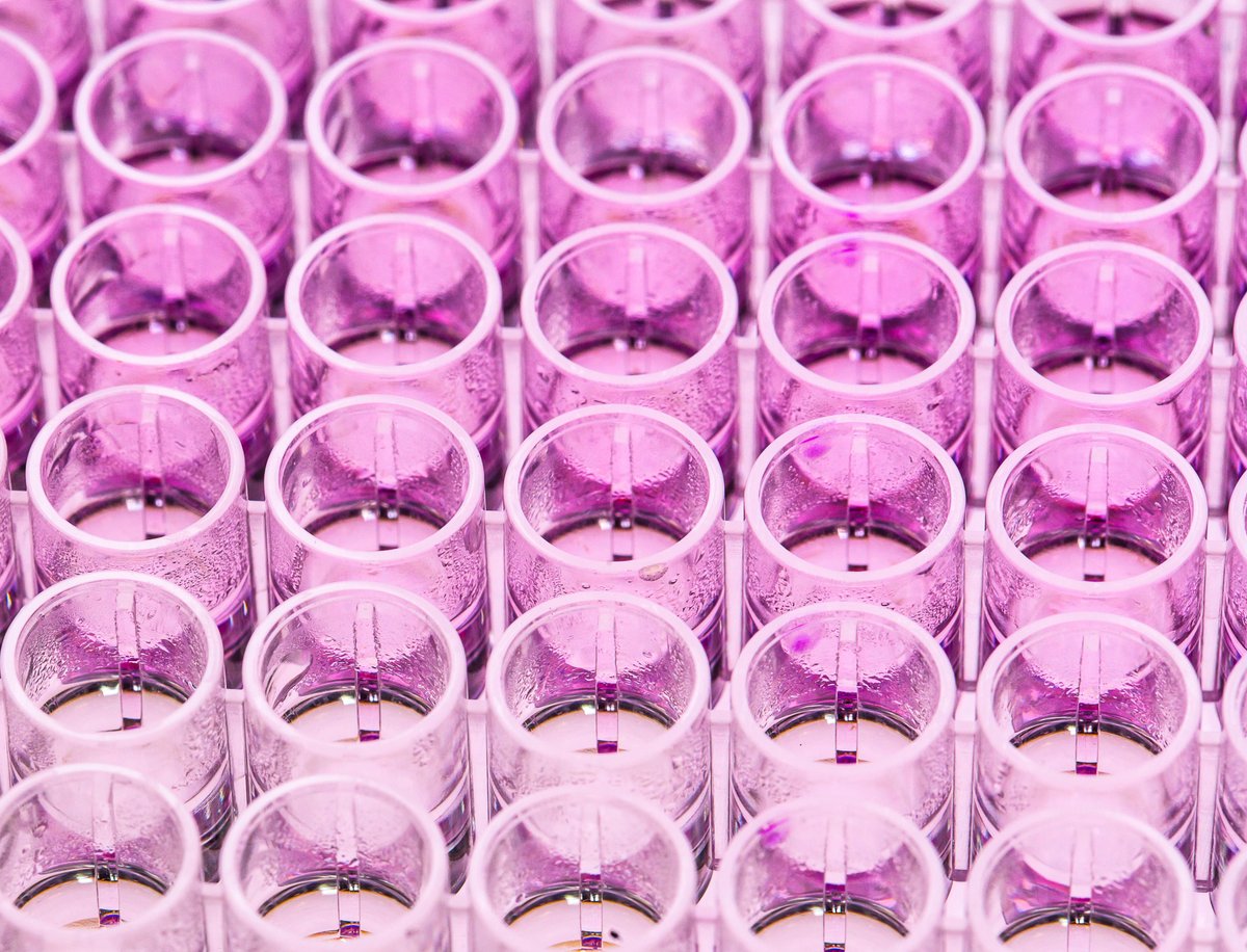 ImmunoChemistry's tweet photo. Learn about our new products: Biochemicals, Metabolic & Fluorescent Assays, & New Apoptosis Kits! Read our latest blog post & visit our website for information on all our new product additions! Stay tuned for more new products, coming soon!
https://t.co/aqqHFw3ktx
#cellviability https://t.co/924SuWGblP