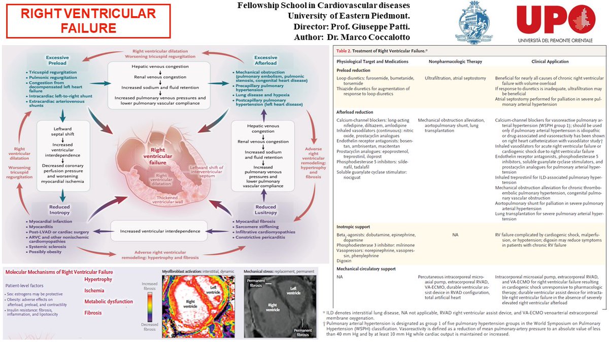 CardioNovara's tweet photo. Cardiology meeting (April 04th, 2023) presented by Dr. M. Coccalotto, under the supervision of Prof. G. Patti, Full Professor of Cardiovascular Diseases (CVDs) at University of Eastern Piedmont and Director of the Department of Thoracic and CVDs at Maggiore della Carità Hospital https://t.co/A3yiNoyVR3
