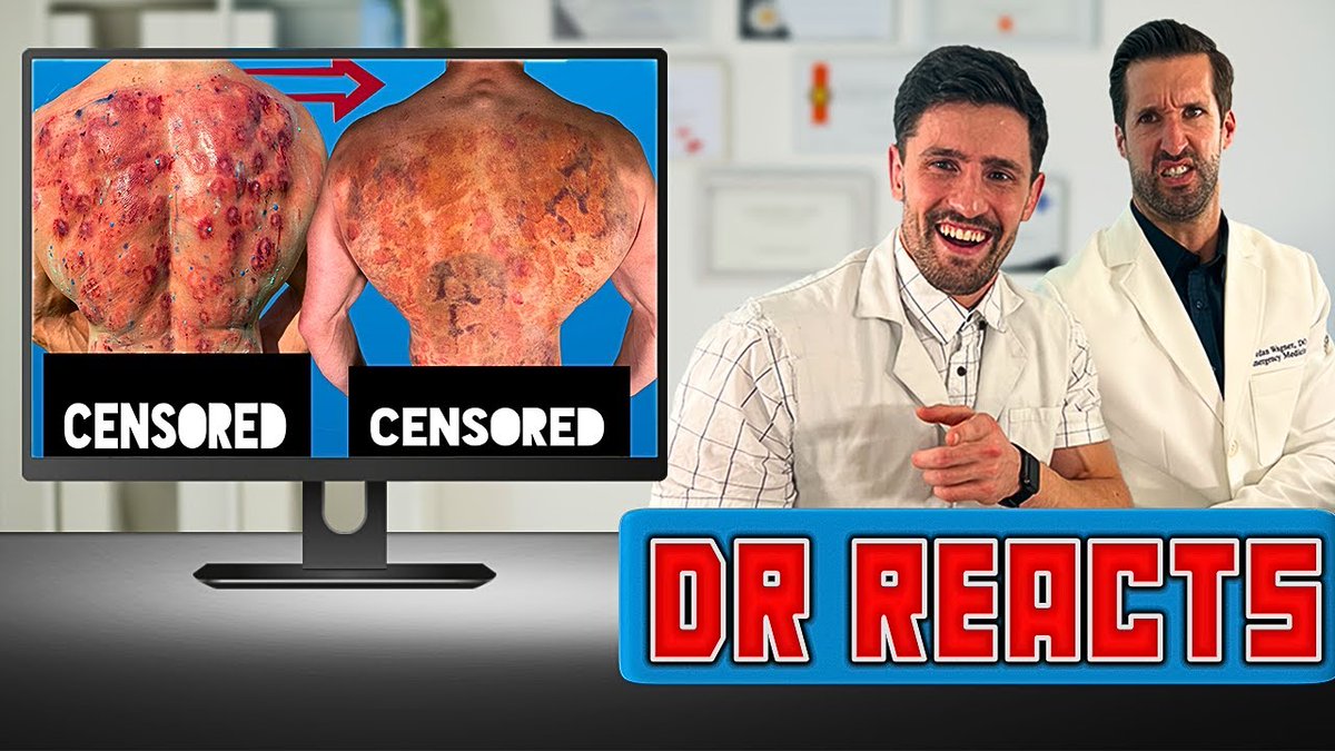 FoGOLF's tweet image. ER Doctor REACTS to my Most ...
 
fogolf.com/489619/er-doct…
 
#BodybuilderVs #BroLabs #DoctorEr #DoctorErReacts #DoctorMike #DoctorMikeReacts #DoctorReaction #DoctorReacts #DoctorWatches #DrEr #DrMike #DrReacts #DrMikeReacts #EmergencyPhysician #ErDoctorReacts #ExpertsReact