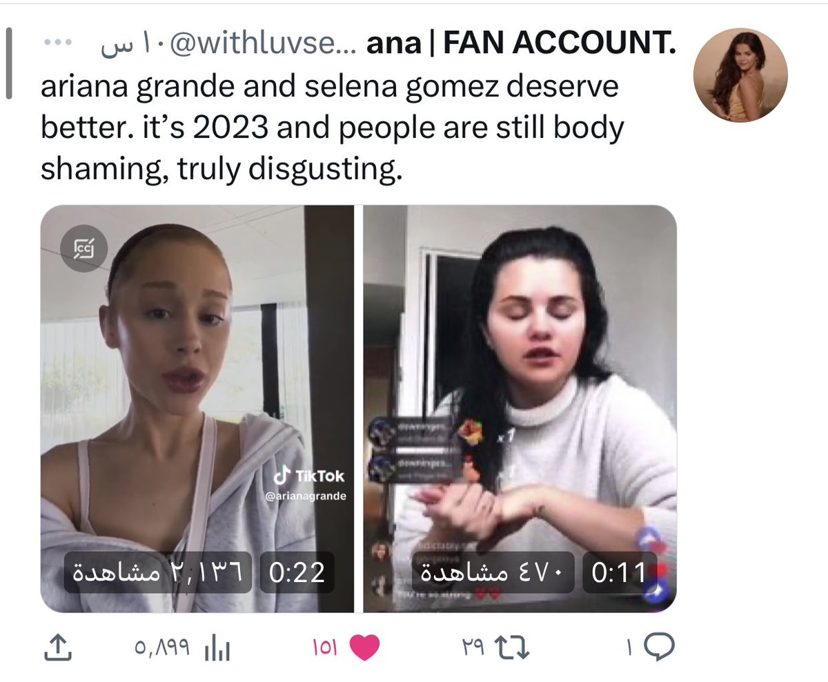 1_kyii's tweet photo. @Gin50557357 @iamgiusee @angelsgrandes Keep lying to yourself .. I won't waste my time on something so obvious . https://t.co/WnuYnMKhLF