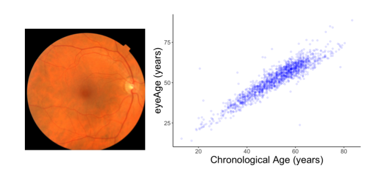 GoogleAI's tweet photo. Images of the retina can provide clues healthcare providers can use to assess a person’s health. In today’s blog, learn how #DeepLearning models can predict biological age from a retinal image and reveal insights that better predict age-related disease → https://t.co/QDqB4UKYWS https://t.co/pfu1jW4TyG