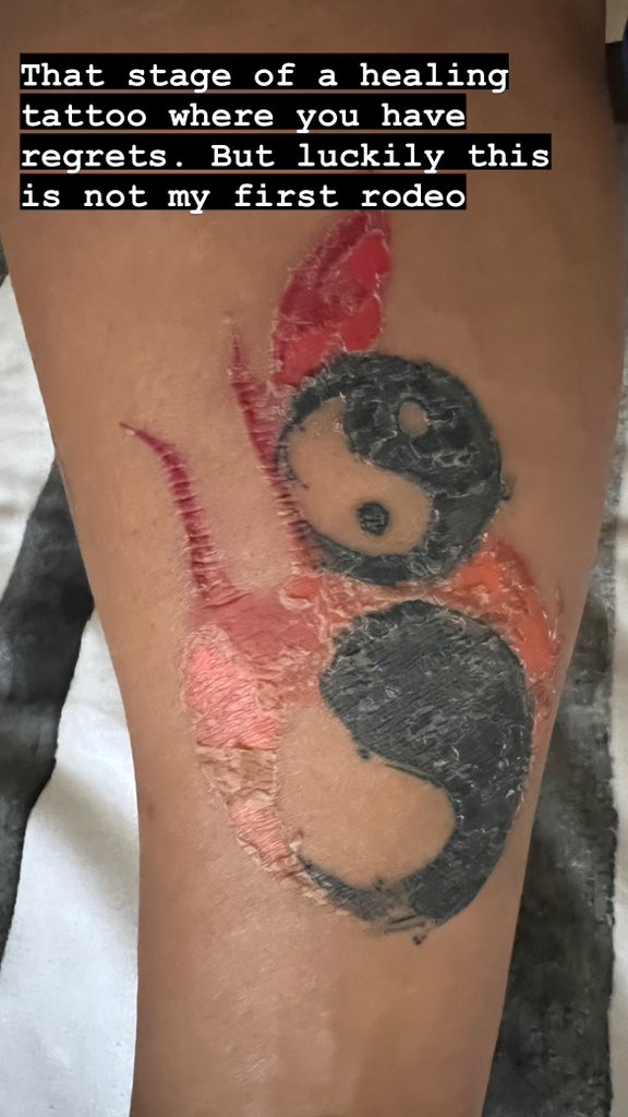 Tattoo Peeling Is It Normal or Is Something Wrong