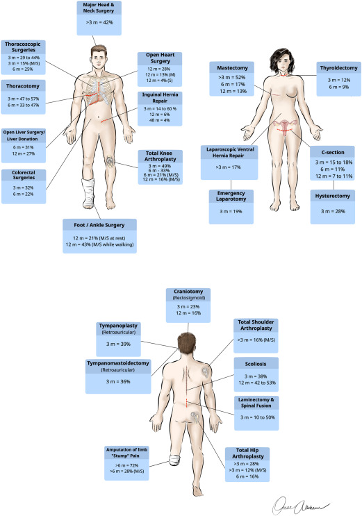 asterkawi's tweet photo. I am pleased to share with you our new publication; addressing a very important and emerging topic (Transitional Pain Medicine).
@vafisalmasi @DrOttestad @DrSeanMackey @StanfordPain @stanfordanes
Enjoy!
https://t.co/6LfKob4qgy...
#painmanagement #chronicpain #TransitionalPain https://t.co/dJTk7dfbvz